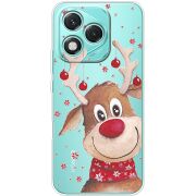 Прозорий чохол BoxFace Honor 400 Lite Winter Deer