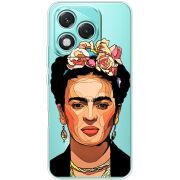 Прозорий чохол BoxFace Honor 400 Lite Фрида Кало