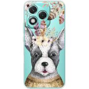 Прозорий чохол BoxFace Honor 400 Lite 