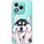 Прозорий чохол BoxFace Honor 400 Lite Husky