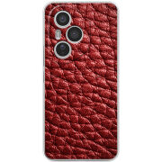 Чохол BoxFace Honor 400 Pro 