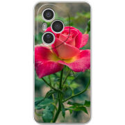 Чохол BoxFace Honor 400 Pro 