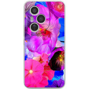 Чохол BoxFace Honor 400 Pro 