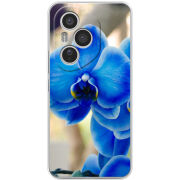 Чохол BoxFace Honor 400 Pro 