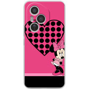 Чохол BoxFace Honor 400 Pro 