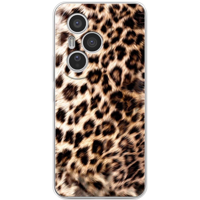 Чохол BoxFace Honor 400 Pro 