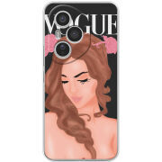 Чохол BoxFace Honor 400 Pro Fashion Girl