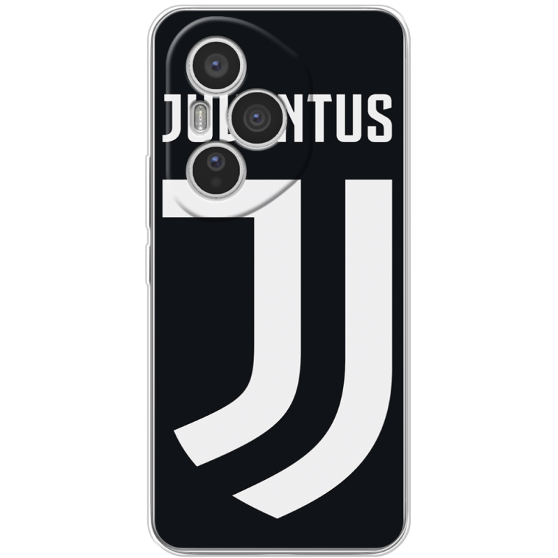 Чохол BoxFace Honor 400 Pro FC J