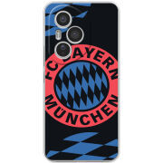 Чохол BoxFace Honor 400 Pro FC Bayern