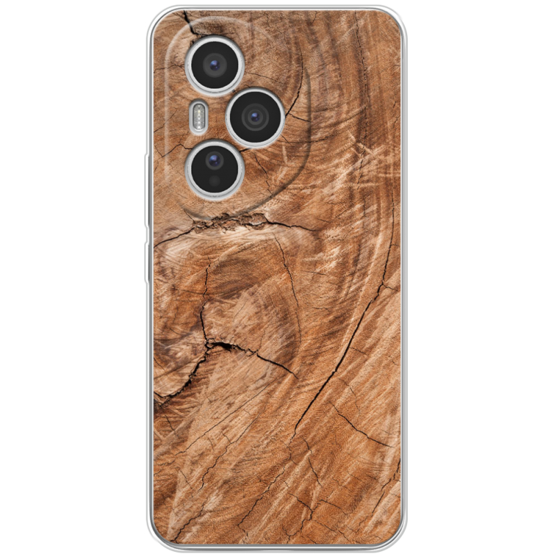 Чохол BoxFace Honor 400 Pro 