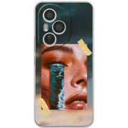 Чохол BoxFace Honor 400 Pro 