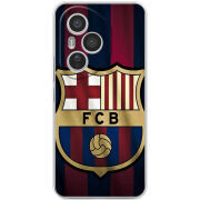 Чохол BoxFace Honor 400 Pro 