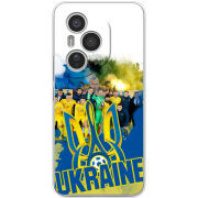 Чохол BoxFace Honor 400 Pro Ukraine national team