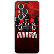 Чохол BoxFace Honor 400 Pro 