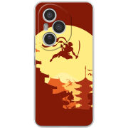 Чохол BoxFace Honor 400 Pro 