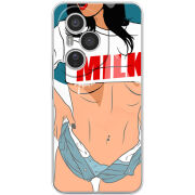 Чохол BoxFace Honor 400 Pro 