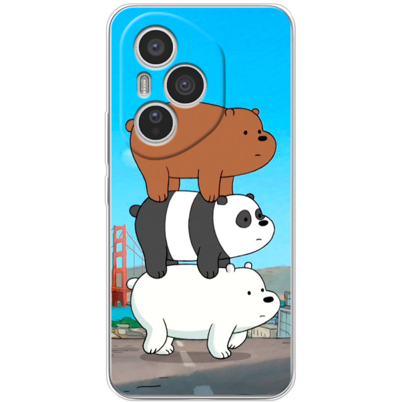 Чохол BoxFace Honor 400 Pro 