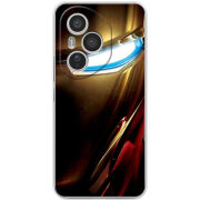 Чохол BoxFace Honor 400 Pro 