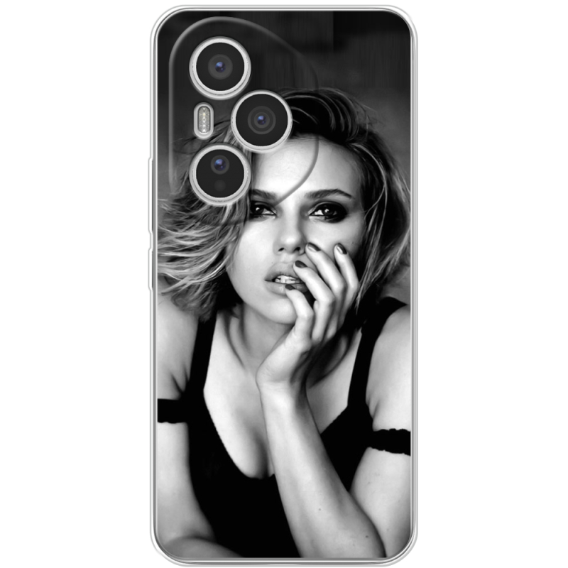 Чохол BoxFace Honor 400 Pro 