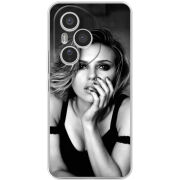 Чохол BoxFace Honor 400 Pro 