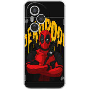 Чохол BoxFace Honor 400 Pro 