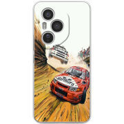 Чохол BoxFace Honor 400 Pro Rally