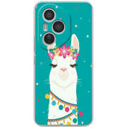 Чохол BoxFace Honor 400 Pro Cold Llama