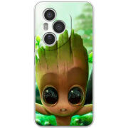 Чохол BoxFace Honor 400 Pro Groot