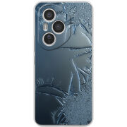 Чохол BoxFace Honor 400 Pro 