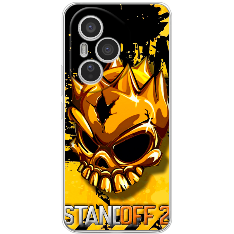 Чохол BoxFace Honor 400 Pro StandOff 2 gold