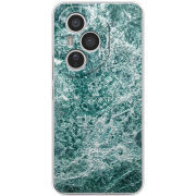 Чохол BoxFace Honor 400 Pro 