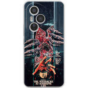 Чохол BoxFace Honor 400 Pro 