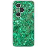 Чохол BoxFace Honor 400 Pro 