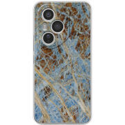 Чохол BoxFace Honor 400 Pro 