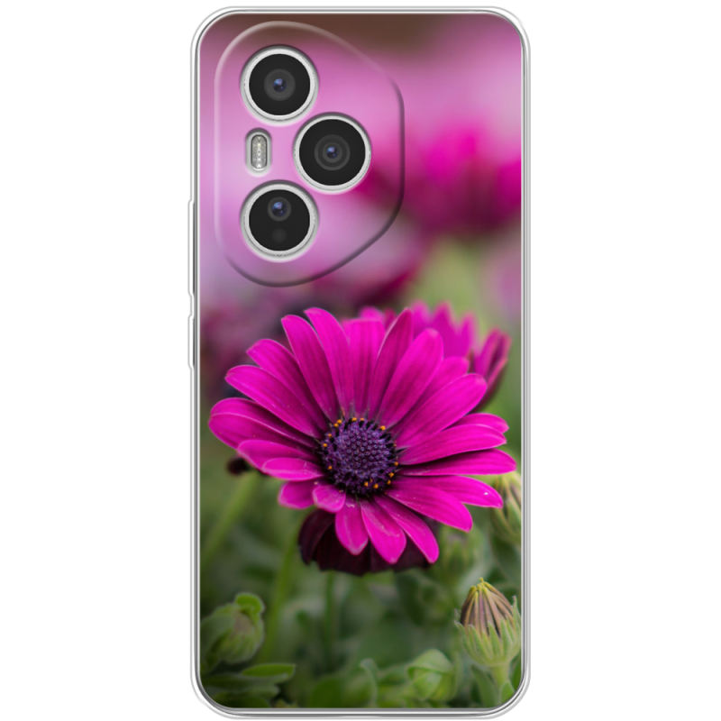 Чохол BoxFace Honor 400 Pro 