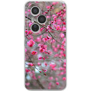 Чохол BoxFace Honor 400 Pro 