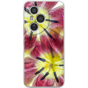 Чохол BoxFace Honor 400 Pro 