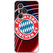 Чохол BoxFace Honor 400 Pro 