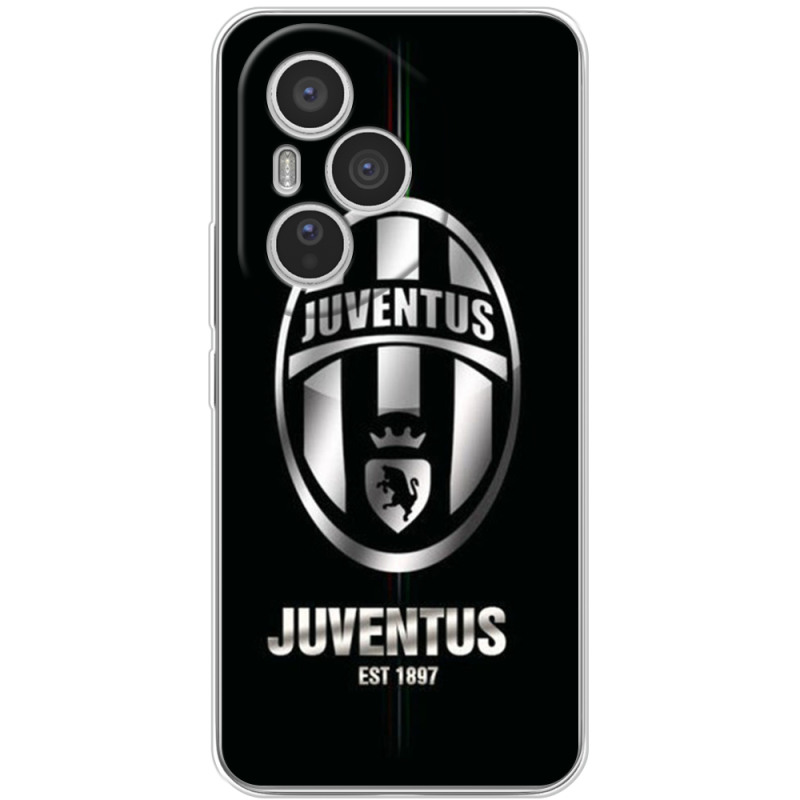 Чохол BoxFace Honor 400 Pro 