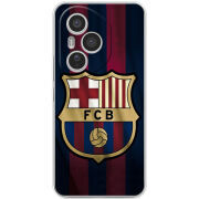 Чохол BoxFace Honor 400 Pro 