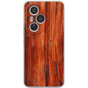 Чохол BoxFace Honor 400 Pro 