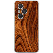 Чохол BoxFace Honor 400 Pro 