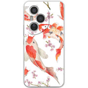 Чохол BoxFace Honor 400 Pro 