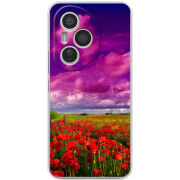 Чохол BoxFace Honor 400 Pro 