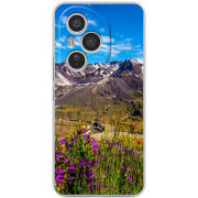 Чохол BoxFace Honor 400 Pro 