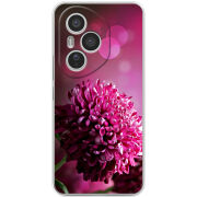 Чохол BoxFace Honor 400 Pro 