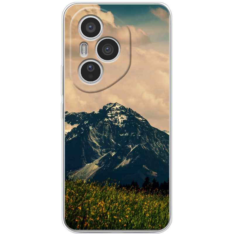 Чохол BoxFace Honor 400 Pro 