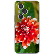 Чохол BoxFace Honor 400 Pro 