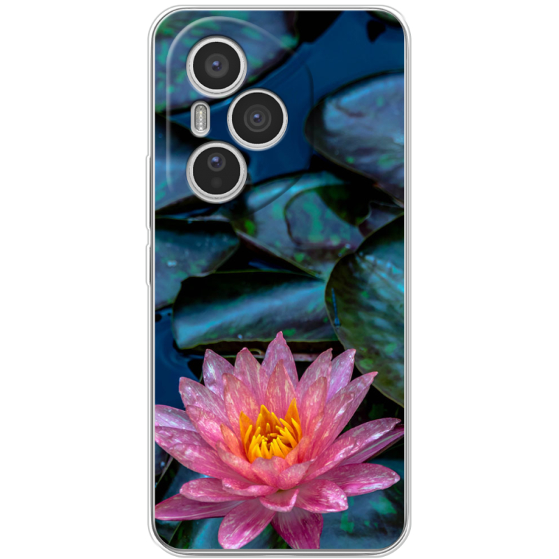 Чохол BoxFace Honor 400 Pro 