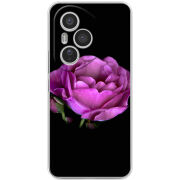 Чохол BoxFace Honor 400 Pro 